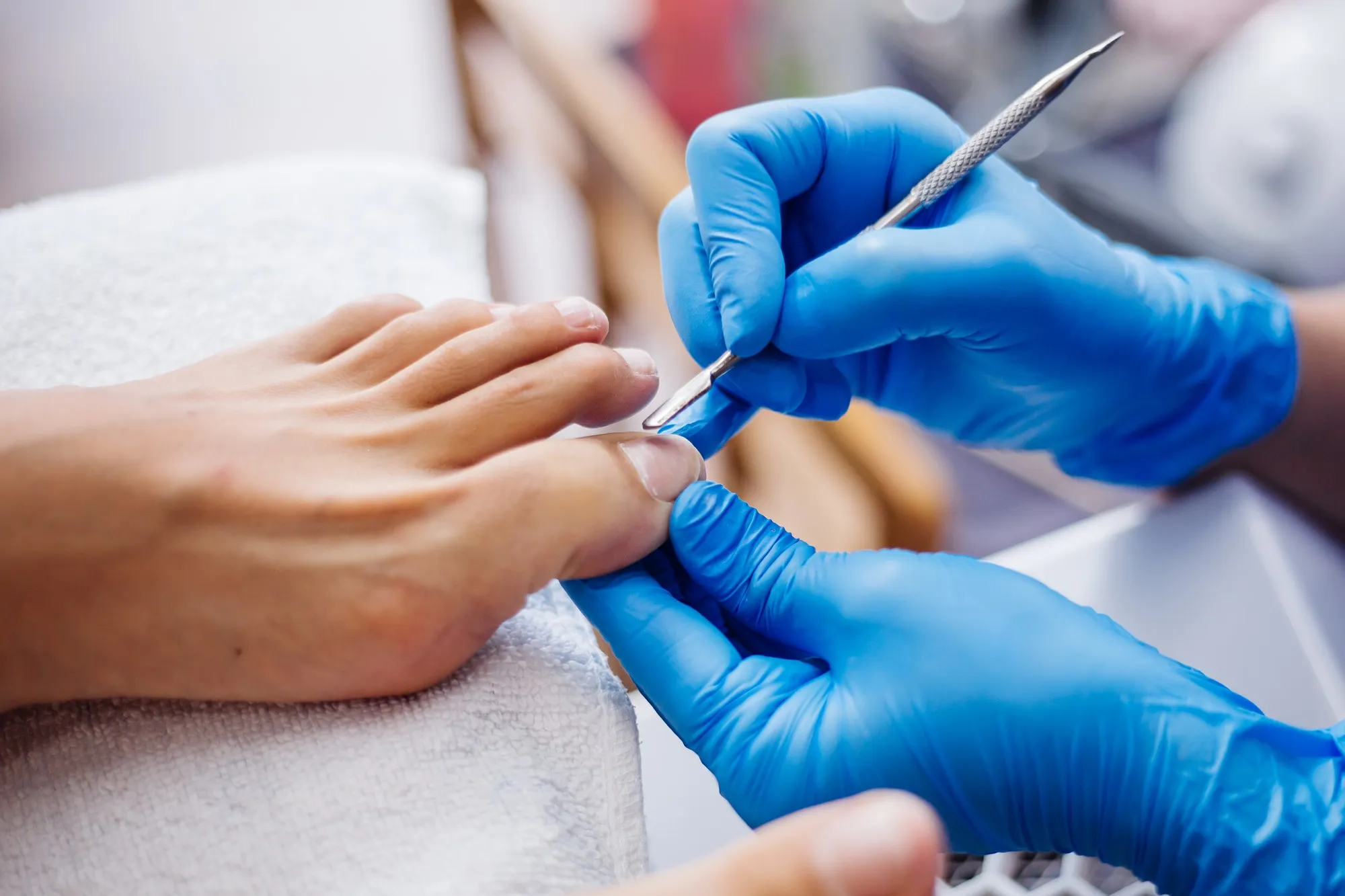 What Are Ingrown Toenails? A Complete Guide